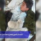 دست امیرحمزه هشت ساله از مچ قطع شد – چه کسی مسئول یک عمر زندگی بدون دست است؟