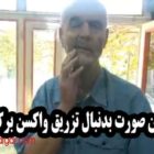 فلج شدن صورت یک آقا بعد از تزریق واکسن برکت